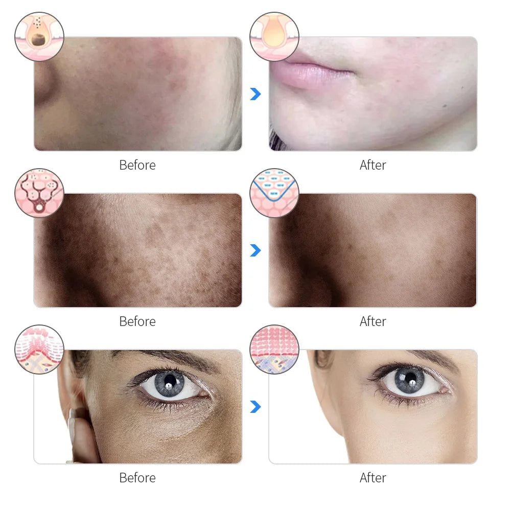 Rechargeable Facial LED Mask 7-Beauty Mask Skin Rejuvenation Home Face Lifting Skin Care Beauty Mask