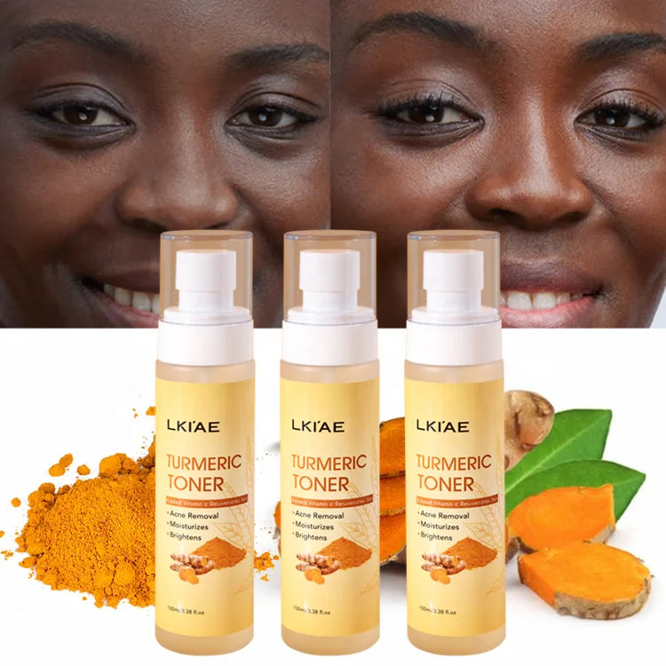 (New) Glowing Turmeric and Vitamin C Spray Acne Prone Moisturizing Face Cosmetics Skin Toner for Oily skin