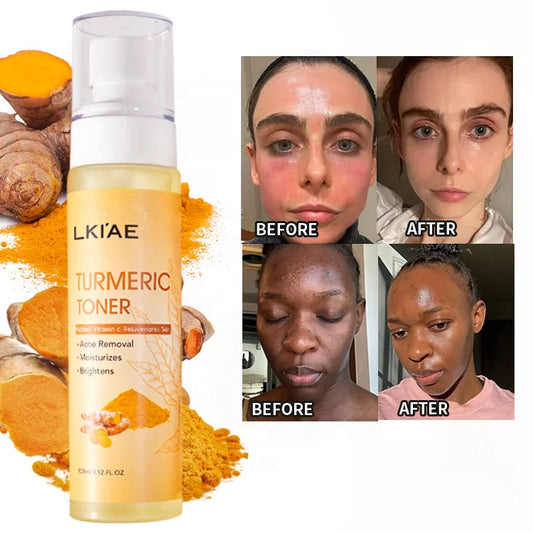 (New) Glowing Turmeric and Vitamin C Spray Acne Prone Moisturizing Face Cosmetics Skin Toner for Oily skin