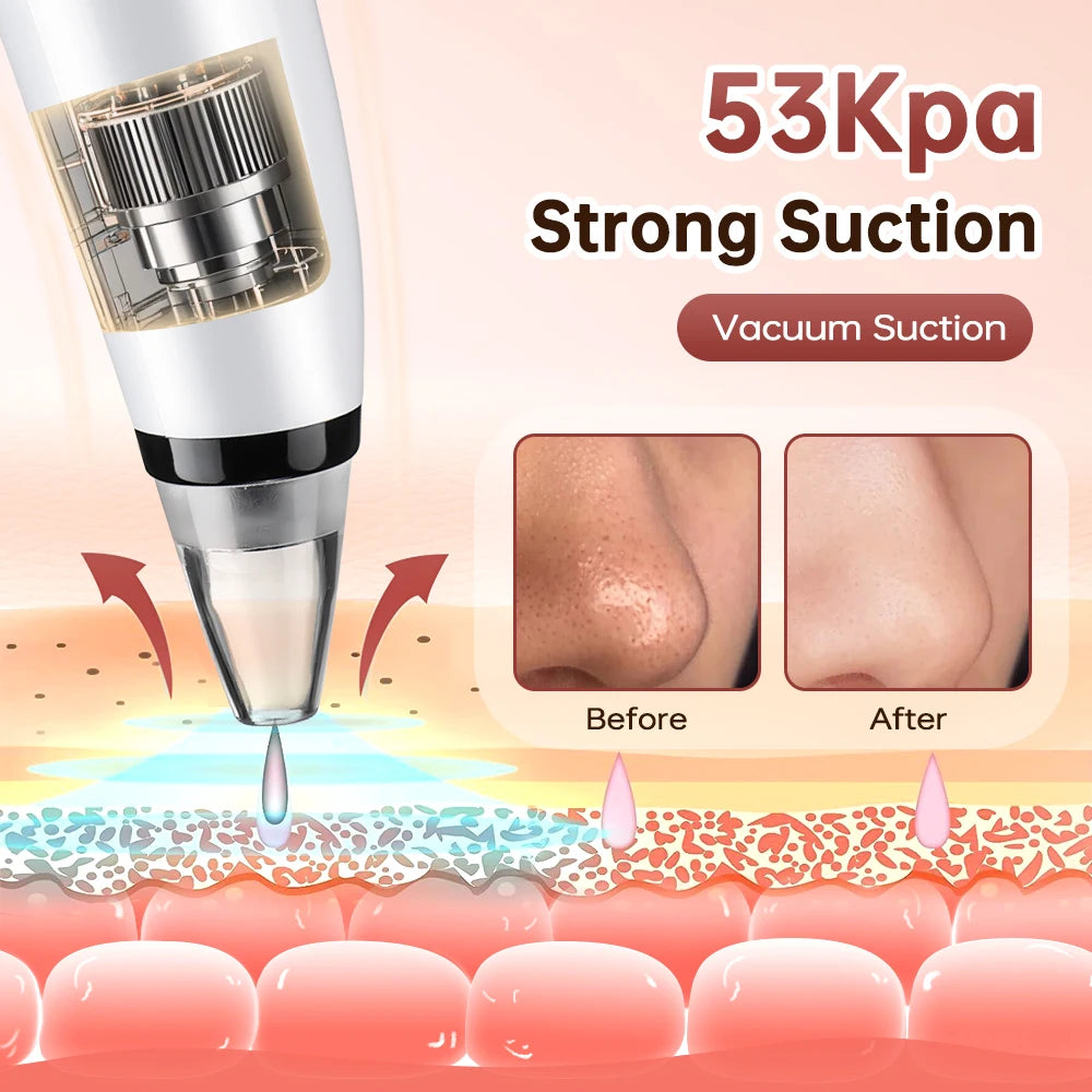 3 Suction Mode Blackhead Remover-Face Cleansing Beauty Machine Dead Skin Remover + Skin Care Tool