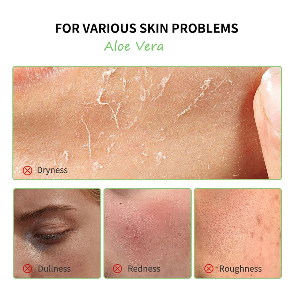 Aloe Vera 5-Piece Skin Care Set – Hydrating & Nourishing Daily Routine