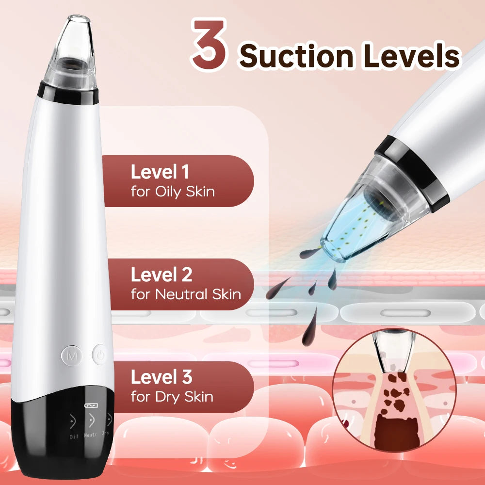 3 Suction Mode Blackhead Remover-Face Cleansing Beauty Machine Dead Skin Remover + Skin Care Tool