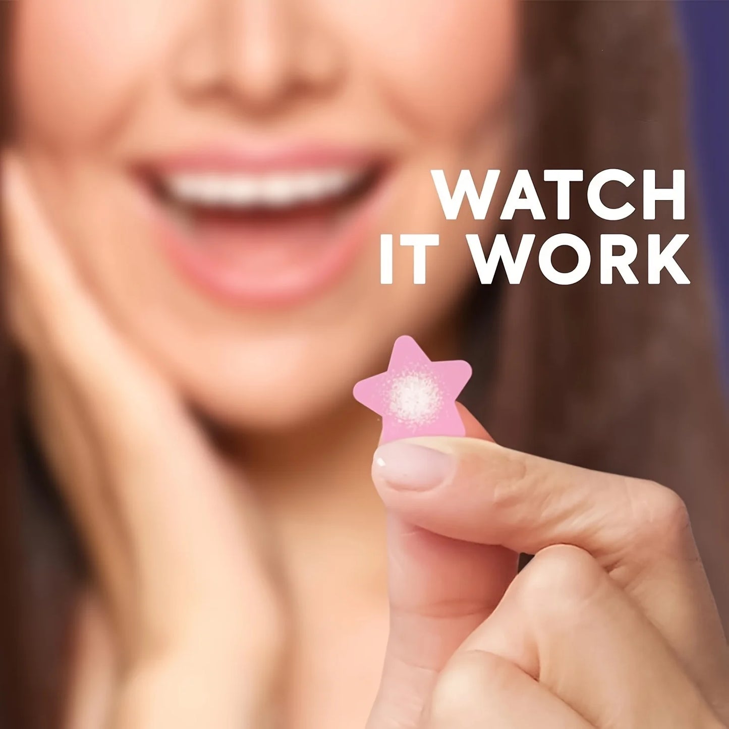 Colorful Star Pimple Patches – 432 Count