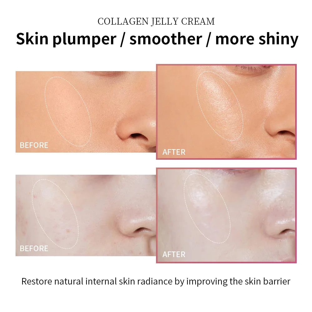 Anti Aging Collagen Face Cream-100ml Niacinamide Moisturizer Hydrating Gel For Tightening Soothing Firmness Skincare