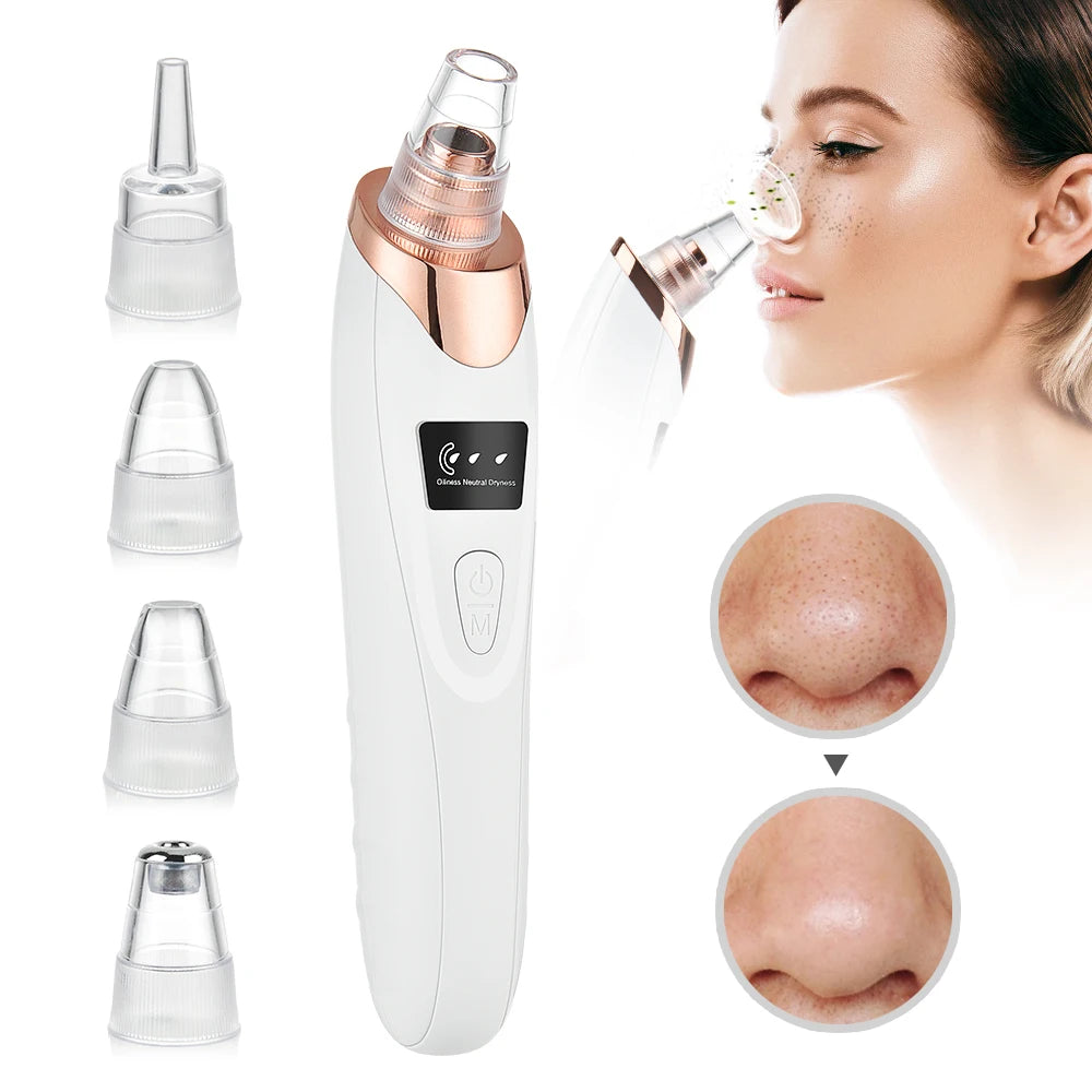3 Suction Mode Blackhead Remover-Face Cleansing Beauty Machine Dead Skin Remover + Skin Care Tool