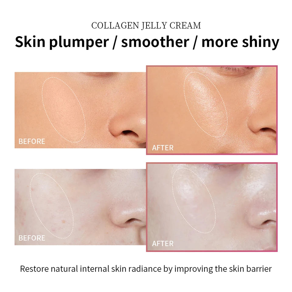 Anti Aging Collagen Face Cream-100ml Niacinamide Moisturizer Hydrating Gel For Tightening Soothing Firmness Skincare