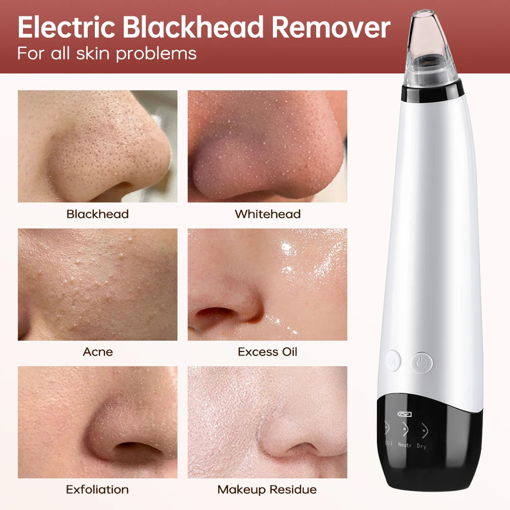 3 Suction Mode Blackhead Remover-Face Cleansing Beauty Machine Dead Skin Remover + Skin Care Tool