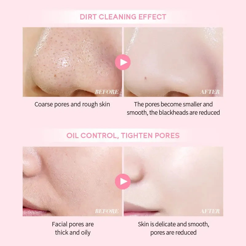 Mud Mask Deep Cleansing Oil Control Balance-Shrink Pores Remove Blackheads Refreshing Facial Mask