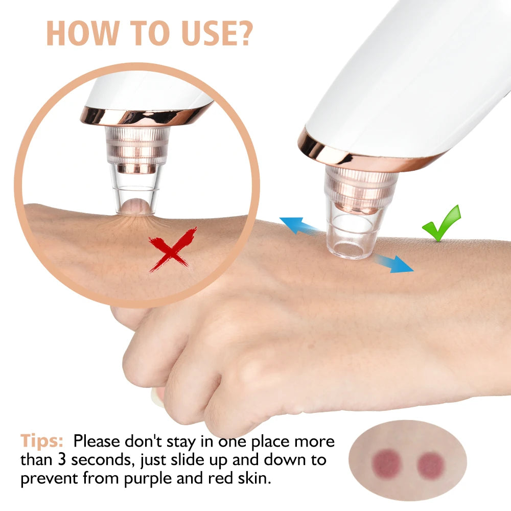 3 Suction Mode Blackhead Remover-Face Cleansing Beauty Machine Dead Skin Remover + Skin Care Tool
