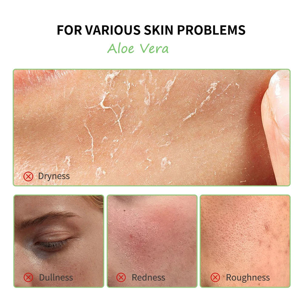Aloe Vera 5-Piece Skin Care Set – Hydrating & Nourishing Daily Routine