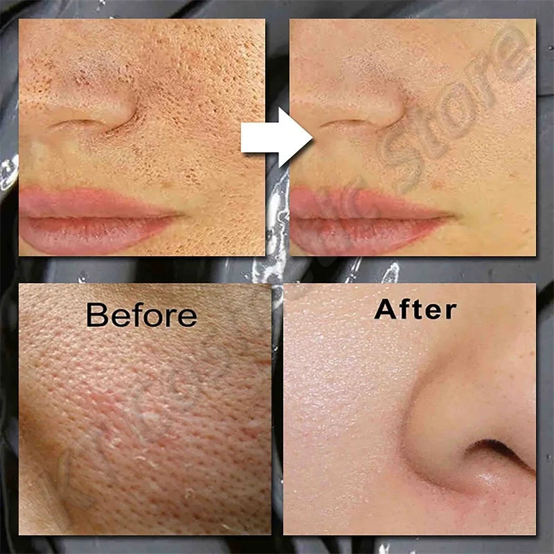 Volcanic Mud Clarifying Face Mask